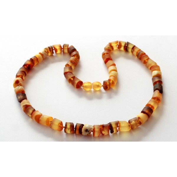 Amber-Necklace